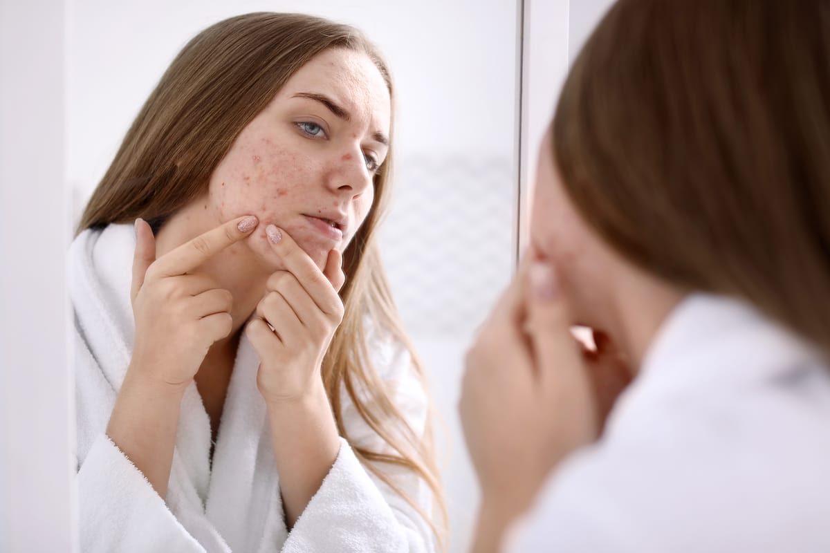 cómo borrar cicatrices de acné