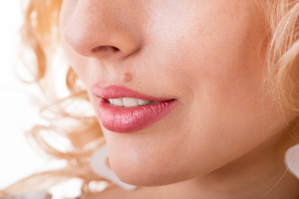 Rostro de una mujer joven con una verruga sobre el labio