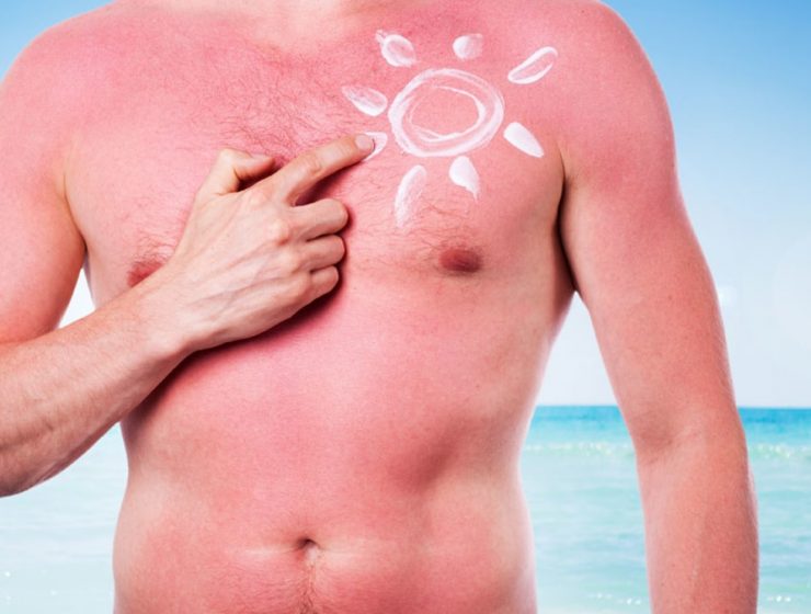 protector solar cancer de piel