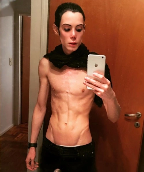 felipe petinatto anorexia