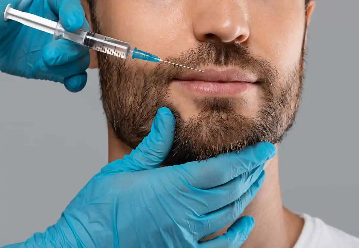 acido hialuronico labios acido hialuronico labios