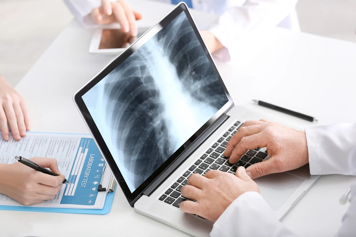 fibrosis quistica cancer pulmon