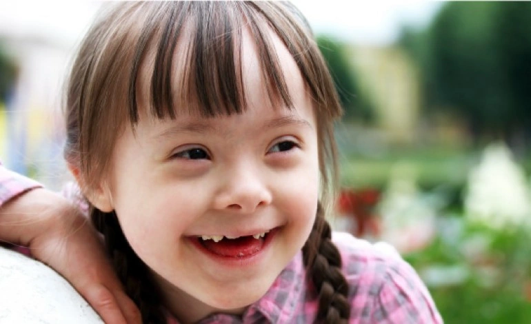 Niña con sindrome de down