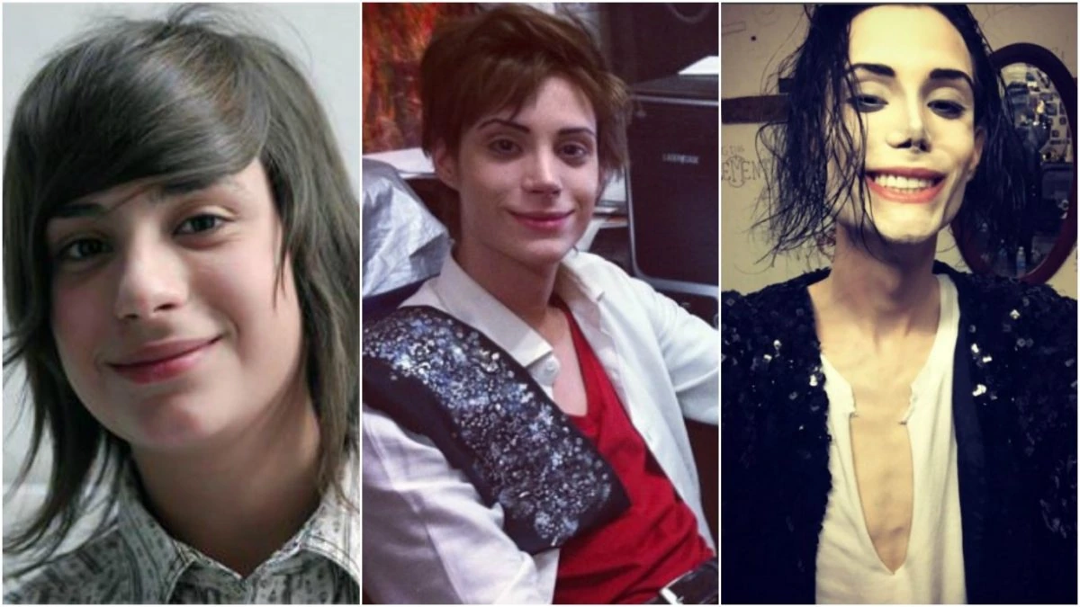 hijo de petinatto antes y despues