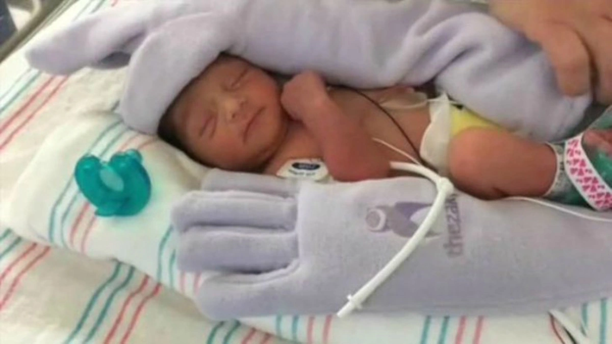 bebe prematuro