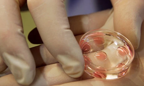 Fertilización In Vitro